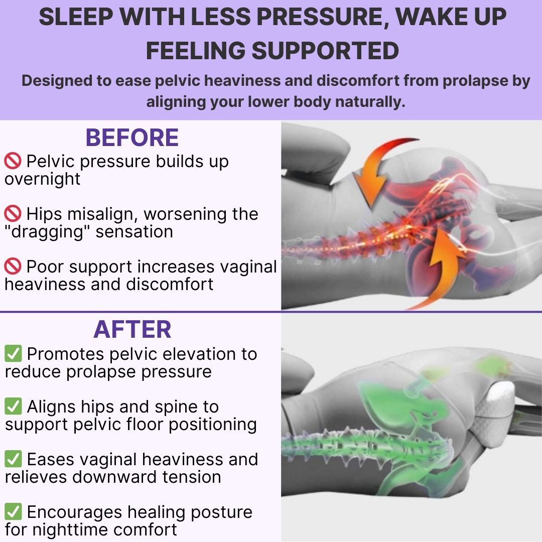Prolapse Pressure Relief Pillow